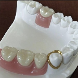 Præcision tilknytning